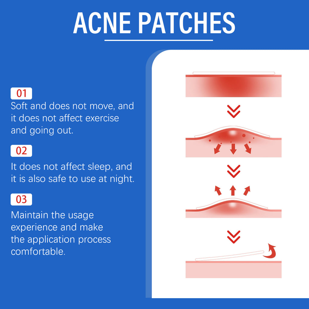 Acne Patch