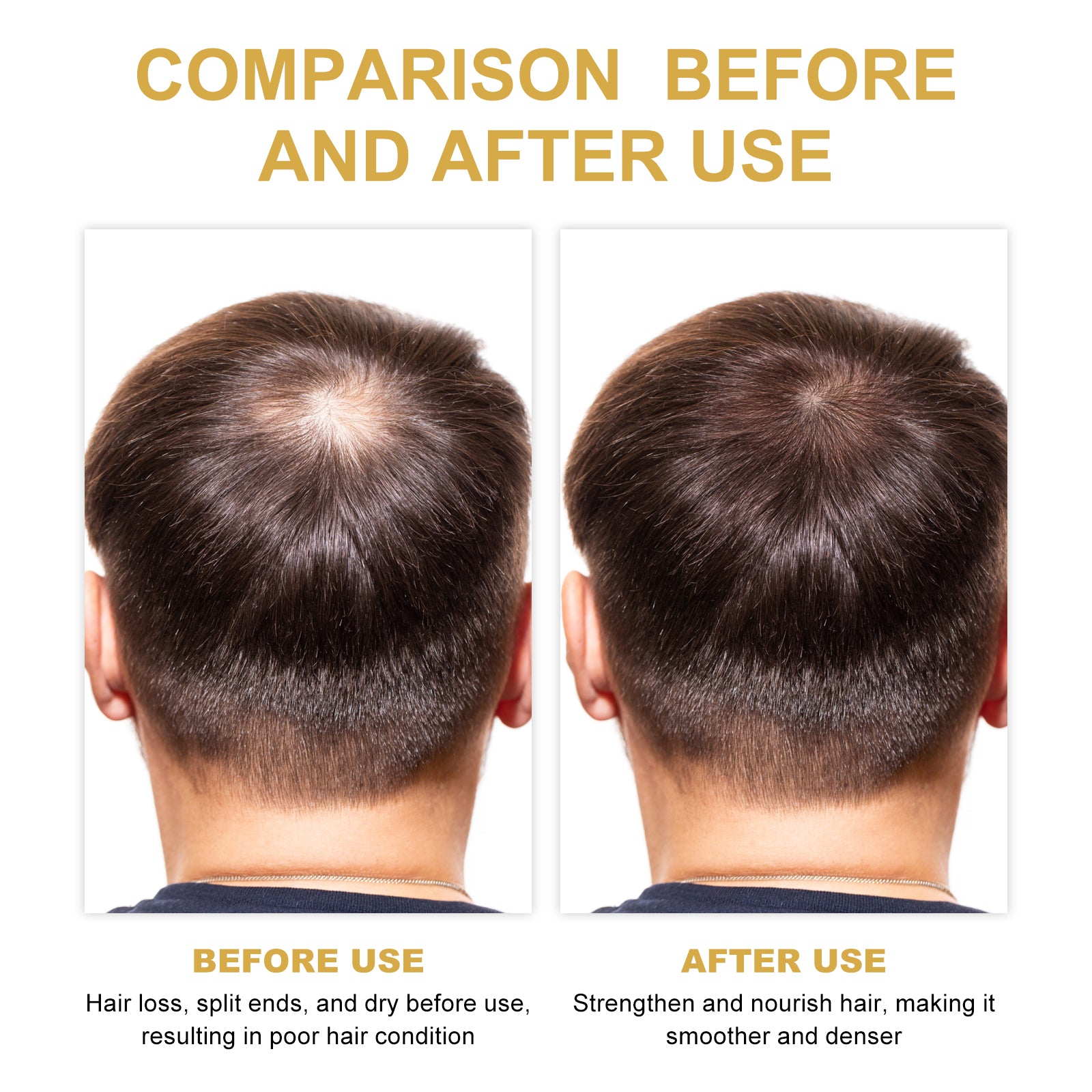 Rosemary Hair Growth Oil - Scalp Treatment & Conditioning